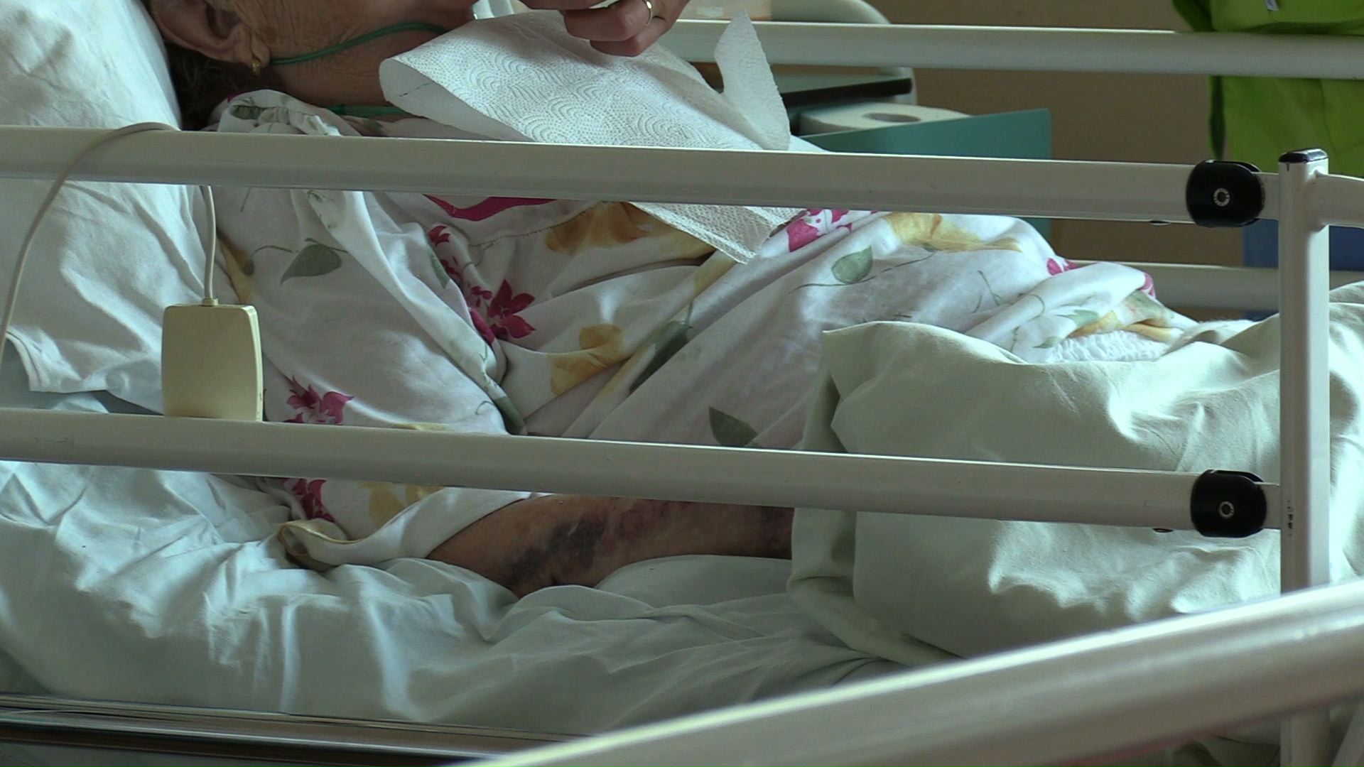 GIS ostrzega przed bąblowicą. Trudno ją zdiagnozować, a jest bardzo niebezpieczna. Jak jej uniknąć, jakie są objawy choroby?