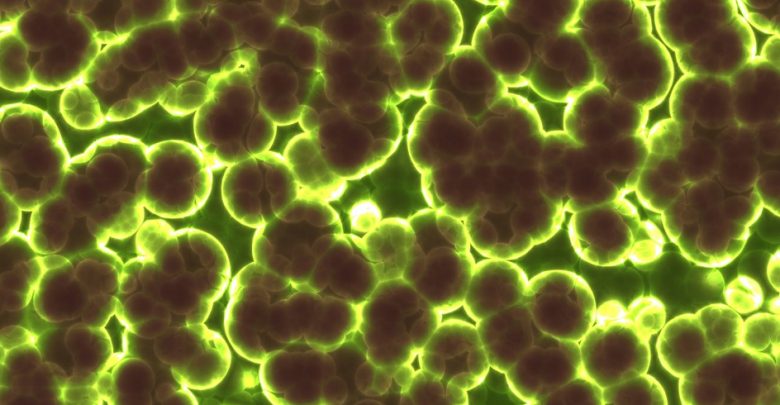 Bakteria New Delhi w Polsce: superbakteria zaatakowała w szpitalu