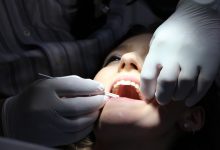 Pszczyna: 500 zarzutów dla dentystki. Grozi jej do 8 lat więzienia. Fot. poglądowe pixabay.com