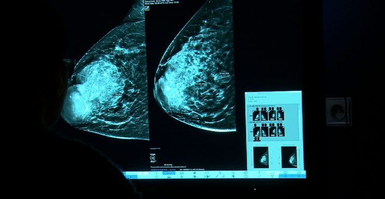 Kierunek Zdrowie: Rak piersi, choroba do leczenia