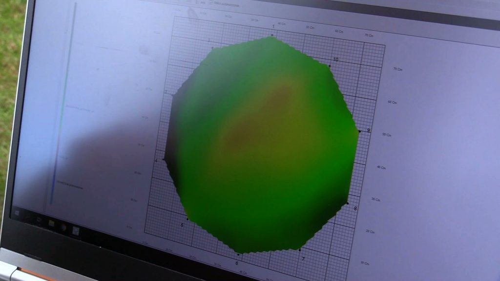 W Dąbrowie Górniczej badają drzewa tomografem komputerowym! Żeby nie było niepotrzebnych wycinek