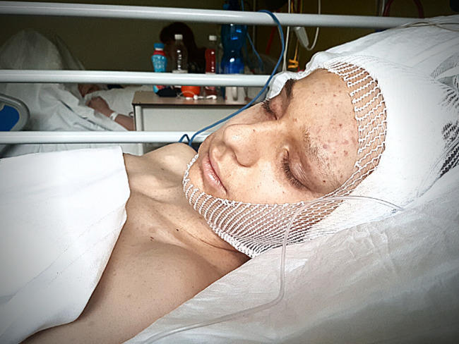 Michałowi potrzebne jest 2 mln złotych na kosztowną rehabilitację.