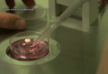 W Częstochowie rusza program in vitro