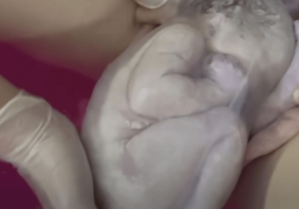 dziecko w czepku urodzone