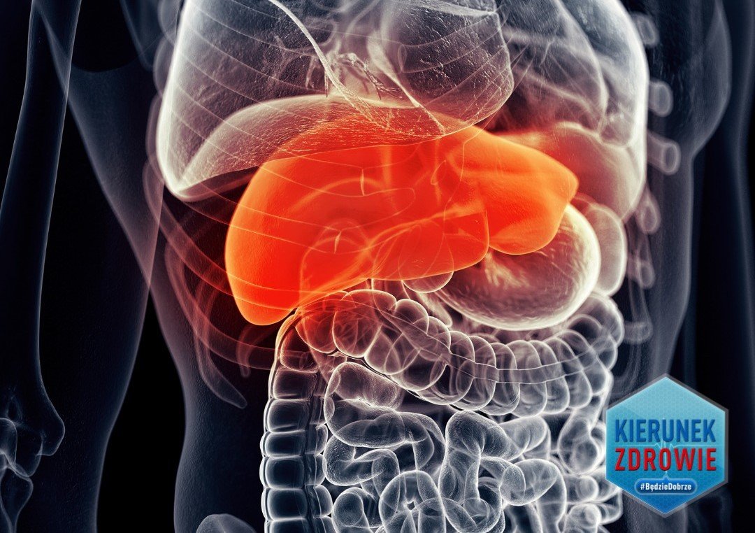 Kierunek Zdrowie. Czym jest niealkoholowe stłuszczenie wątroby?