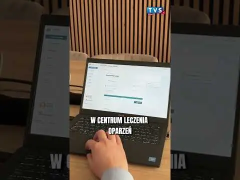Obrazek YouTube: Sztuczna inteligencja pomaga lekarzom na Śląsku!